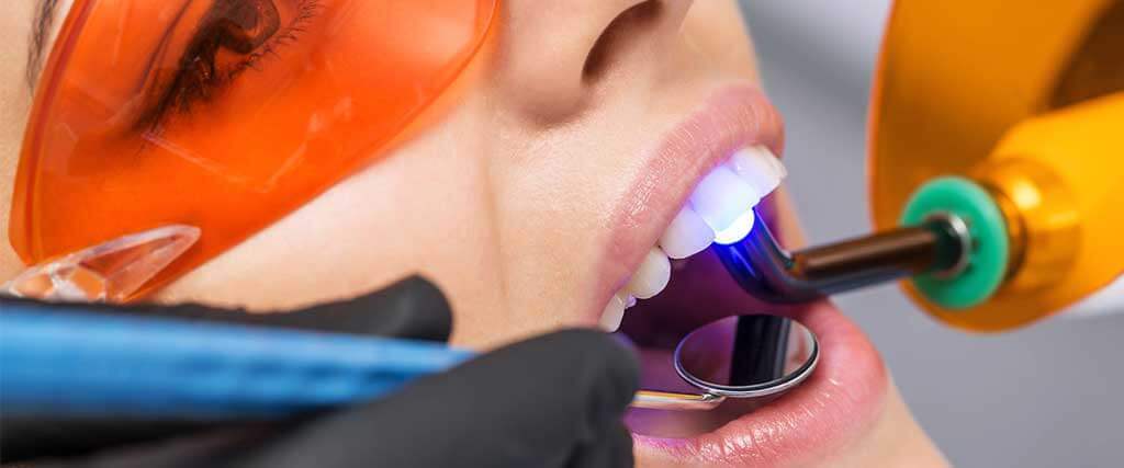 چگونه لایت کیورینگ مطمئن داشته باشیم؟